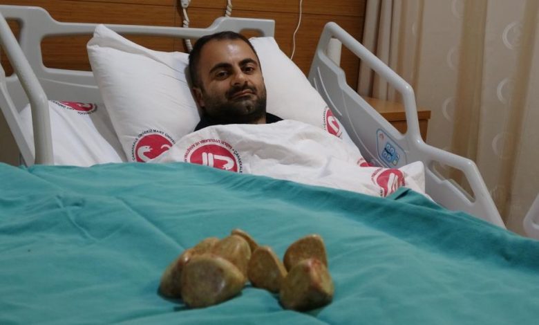 Mesanesinden 550 gram ağırlığında 20 taş çıkarıldı 1 AW764056 03 |