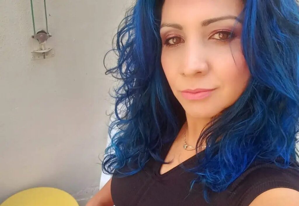 ispanyadan estetik icin istanbula gelen turist ameliyat sonrasi hayatini kaybetti 4fdc76f e1723027947856 |