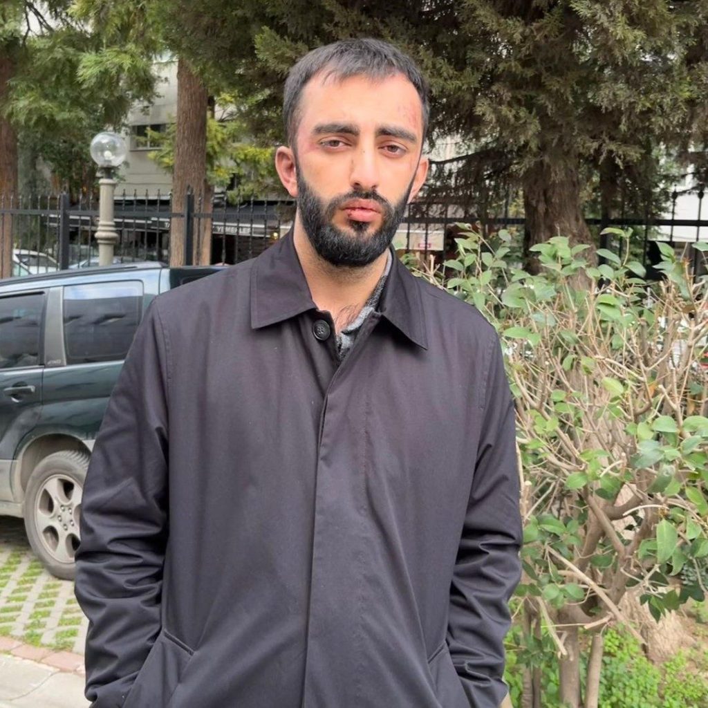 basibos kopekler cocuguna bez almaya giden vatandasa saldirdi 15f32ef14440 |