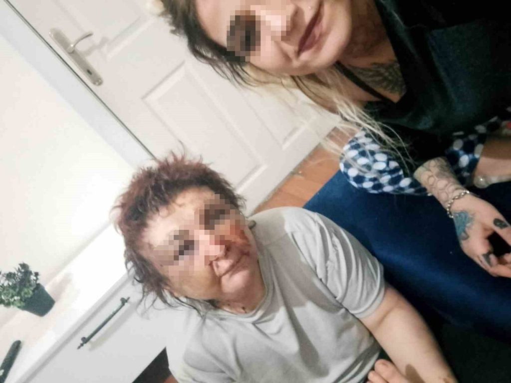 zorla alikoyduklari kadini darbeden 2 supheli gozaltina alindi e1432dc6f551 |