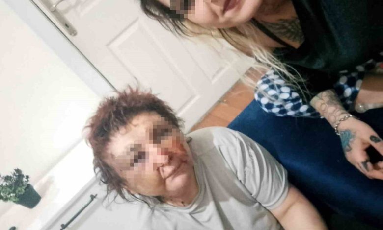 zorla alikoyduklari kadini darbeden 2 supheli gozaltina alindi e1432dc6f551 |