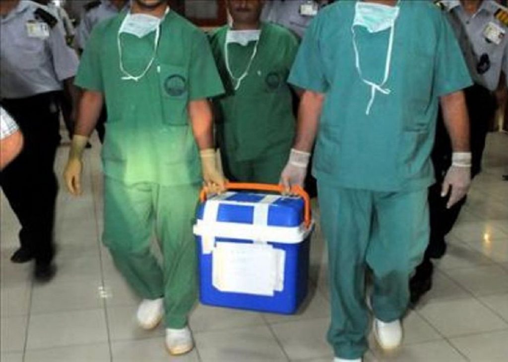 canli vericiden bobrek nakli |