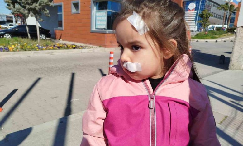 İzmir’de AVM’deki sahipsiz köpek 3 yaşındaki Elif’e saldırdı 1 izmirde avmdeki sahipsiz kopek 3 yasindaki elife saldirdi fed6924dccab |