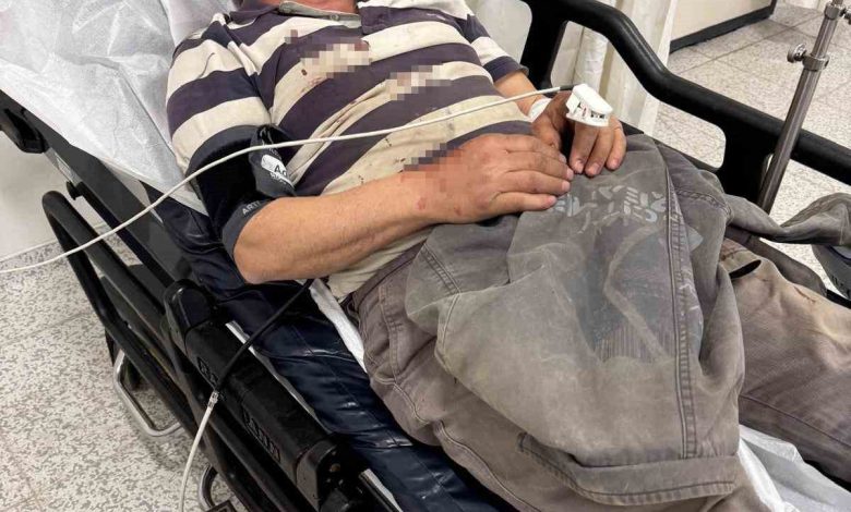 Komşular arasında kaçak yapı kavgası: 2 yaralı 1 komsular arasinda kacak yapi kavgasi 2 yarali d10ba758fec6 |