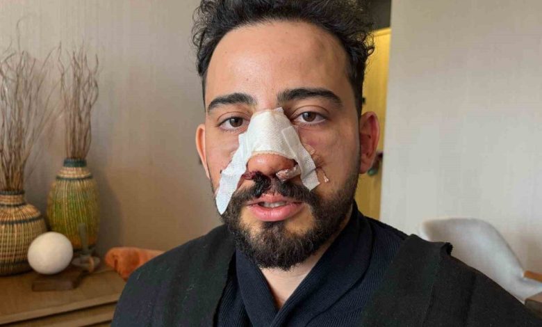 Siparişler geciktiği için gitmek isteyen müşteriye restoran çalışanlarından öldüresiye darp 1 siparisler geciktigi icin gitmek isteyen musteriye restoran calisanlarindan olduresiye darp fd15d3df1130 |