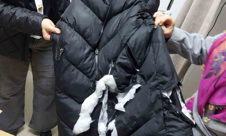Köpeklerin saldırısına uğrayan kadın yaralandı: O anlar kameraya yansıdı 1 kopeklerin saldirisina ugrayan kadin yaralandi o anlar kameraya yansidi 7ac0b4eac5d1 |