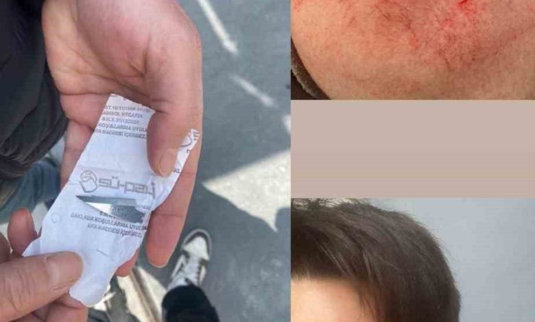 Milli sporcuya eski antrenörü saldırdı; vücudunda çok sayıda kesik oluştu 1 milli sporcuya eski antrenoru saldirdi vucudunda cok sayida kesik olustu 0dec9bcfb95c |