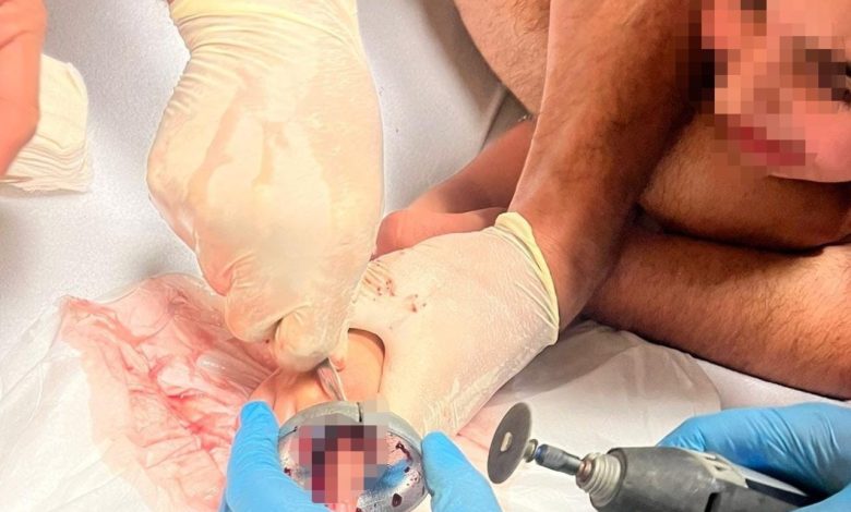 Bursa’da çocuğun parmağı çeşme aynasına sıkıştı 1 bursada cocugun parmagi cesme aynasina sikisti a4be01aa1e40 |