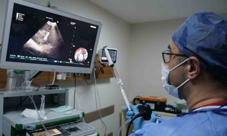 İEÜ Medical Point Hastanesi Akciğer Sağlığı Merkezi’nde EBUS ile ameliyatsız tanı 1 ieu medical point hastanesi akciger sagligi merkezinde ebus ile ameliyatsiz tani e67012c85695 |