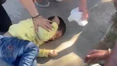 yuruyus yoluna giren motosikletli 35 yasindaki cocuga carpti 1675c6b241e1 |