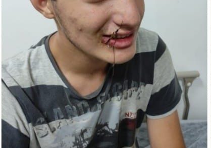 bu kez oltaya cocuk takildi f129fe04b743 |