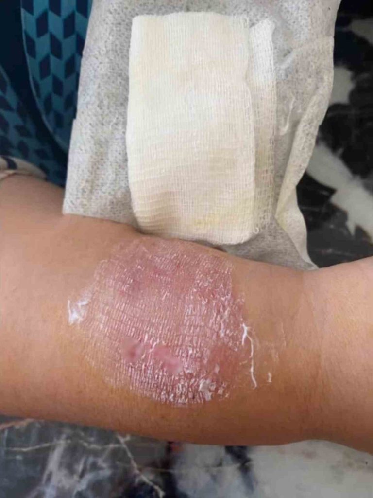 buyukcekmecede sigara dumani tartismasinda kolunu isirdi 4a0855692dbc |