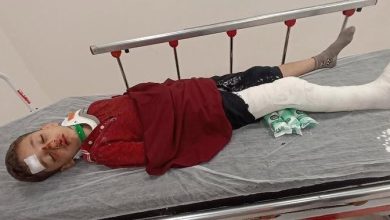 basaksehirde 8 yasindaki cocuga trafige kapali alanda motosiklet carpti baba yardim istedi f7c4b11cdc7a |