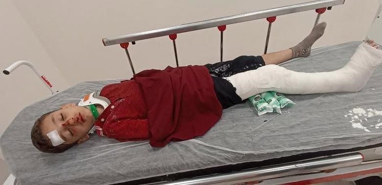 basaksehirde 8 yasindaki cocuga trafige kapali alanda motosiklet carpti baba yardim istedi f7c4b11cdc7a |