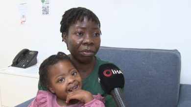 down sendromlu minik kutenda kritik kalp hastaligini turkiyede atlatti 27fdf4ae5aa1 |