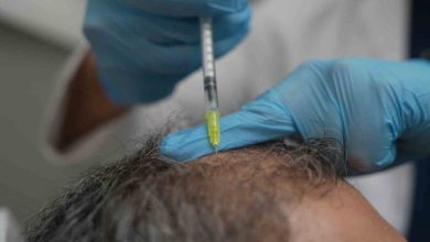 Dökülen saçlar vücudun bir alarmı olabilir 4 dokulen saclar vucudun bir alarmi olabilir ae03afbe7c45 |