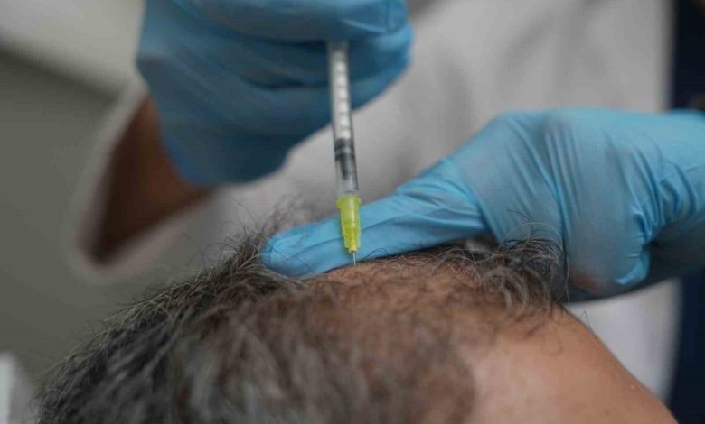 dokulen saclar vucudun bir alarmi olabilir ae03afbe7c45 |