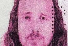 ingiliz vatandasi turkiyede sac ekimi ve dis tedavisi ardindan hayatini kaybetti bdf8e32c9c88 |