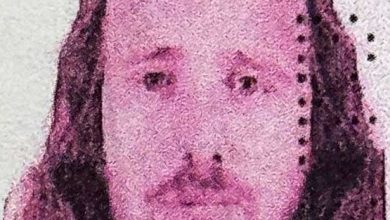 ingiliz vatandasi turkiyede sac ekimi ve dis tedavisi ardindan hayatini kaybetti bdf8e32c9c88 |