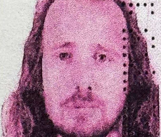 ingiliz vatandasi turkiyede sac ekimi ve dis tedavisi ardindan hayatini kaybetti bdf8e32c9c88 |