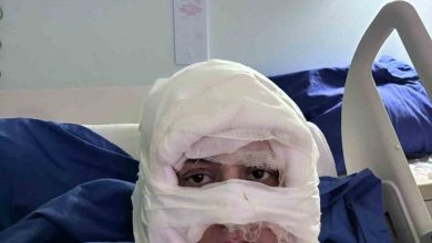 kadikoyde akil almaz olay genc kadin baska bir kadin tarafindan atese verildi b53e449508aa |