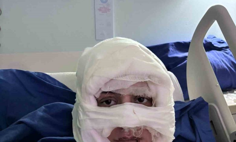 kadikoyde akil almaz olay genc kadin baska bir kadin tarafindan atese verildi b53e449508aa |