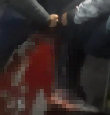 Üsküdar’da bıçaklı kavga : 1 yaralı 1 uskudarda bicakli kavga 1 yarali ed5c1afceaca |