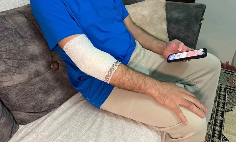 basaksehirde sitenin guvenlik gorevlisine sahipli kopek saldirdi c429701e512c |